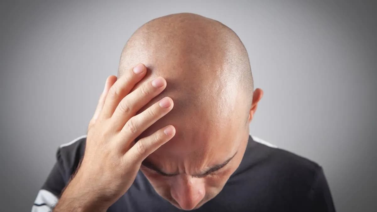 Avance en el tratamiento de la alopecia por investigadores españoles
